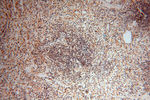 GMFG Antibody in Immunohistochemistry (Paraffin) (IHC (P))