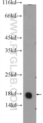 GMFG Antibody in Western Blot (WB)