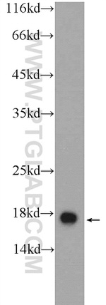 GMFG Antibody in Western Blot (WB)