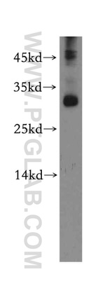 NSMCE2 Antibody in Western Blot (WB)