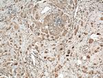 RALA Antibody in Immunohistochemistry (Paraffin) (IHC (P))