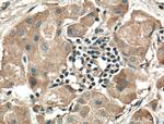 RALA Antibody in Immunohistochemistry (Paraffin) (IHC (P))