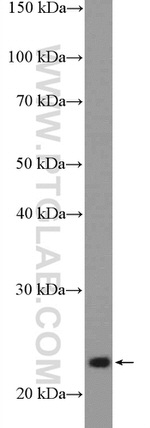 RALA Antibody in Western Blot (WB)