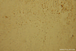 POLI Antibody in Immunohistochemistry (Paraffin) (IHC (P))