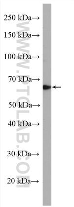 TULP3 Antibody in Western Blot (WB)