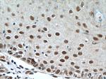 DSS1 Antibody in Immunohistochemistry (Paraffin) (IHC (P))