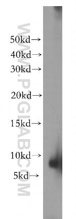 DSS1 Antibody in Western Blot (WB)