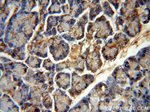 BCAT1/ECA39 Antibody in Immunohistochemistry (Paraffin) (IHC (P))