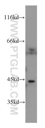 BCAT1/ECA39 Antibody in Western Blot (WB)