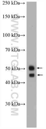 BCAT1/ECA39 Antibody in Western Blot (WB)