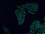 BCAT1/ECA39 Antibody in Immunocytochemistry (ICC/IF)