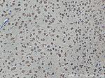 BCAT1/ECA39 Antibody in Immunohistochemistry (Paraffin) (IHC (P))