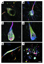 Tau Antibody in Immunohistochemistry (IHC)