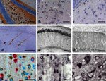 Tau Antibody in Immunohistochemistry (IHC)