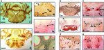 Tau Antibody in Immunohistochemistry (IHC)