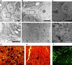 Tau Antibody in Immunohistochemistry (IHC)