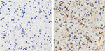 Tau Antibody in Immunohistochemistry (Paraffin) (IHC (P))