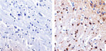 Tau Antibody in Immunohistochemistry (Paraffin) (IHC (P))
