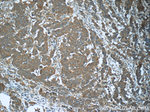 WDR19/IFT144 Antibody in Immunohistochemistry (Paraffin) (IHC (P))