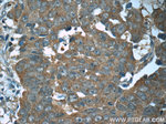 WDR19/IFT144 Antibody in Immunohistochemistry (Paraffin) (IHC (P))