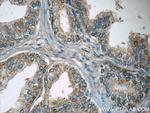 WDR19/IFT144 Antibody in Immunohistochemistry (Paraffin) (IHC (P))