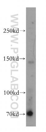 WDR19/IFT144 Antibody in Western Blot (WB)