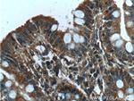 NARFL Antibody in Immunohistochemistry (Paraffin) (IHC (P))