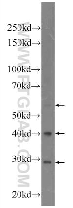 NARFL Antibody in Western Blot (WB)