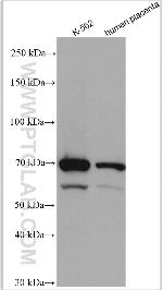 ENTPD2 Antibody in Western Blot (WB)