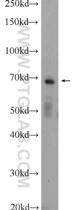 ENTPD2 Antibody in Western Blot (WB)