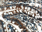 SLC35A2 Antibody in Immunohistochemistry (Paraffin) (IHC (P))