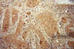 GART Antibody in Immunohistochemistry (Paraffin) (IHC (P))