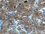 GART Antibody in Immunohistochemistry (Paraffin) (IHC (P))