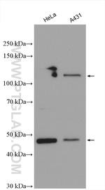 GART Antibody in Western Blot (WB)