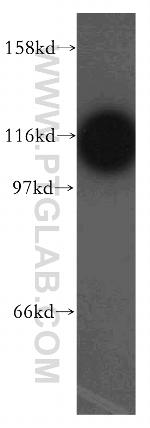 GART Antibody in Western Blot (WB)