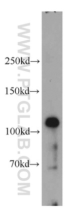 GART Antibody in Western Blot (WB)