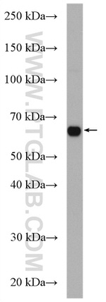 CDC14A Antibody in Western Blot (WB)