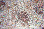 LTA4H Antibody in Immunohistochemistry (Paraffin) (IHC (P))