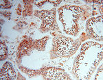 LTA4H Antibody in Immunohistochemistry (Paraffin) (IHC (P))