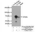 LTA4H Antibody in Immunoprecipitation (IP)
