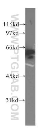 CTNNBL1 Antibody in Western Blot (WB)