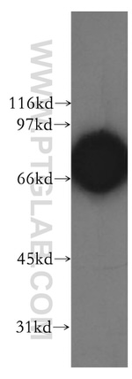 CTNNBL1 Antibody in Western Blot (WB)