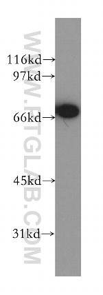 CTNNBL1 Antibody in Western Blot (WB)