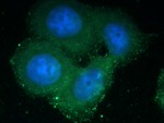 PEX1 Antibody in Immunocytochemistry (ICC/IF)