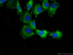 PEX1 Antibody in Immunocytochemistry (ICC/IF)