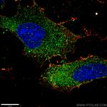 PEX1 Antibody in Immunocytochemistry (ICC/IF)