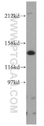 PEX1 Antibody in Western Blot (WB)