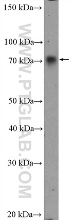 WDR1 Antibody in Western Blot (WB)