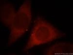 MPPED1 Antibody in Immunocytochemistry (ICC/IF)