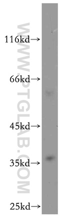 MPPED1 Antibody in Western Blot (WB)